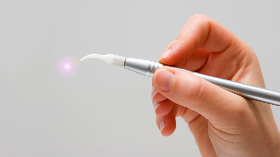 Dental Laser